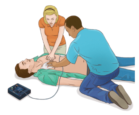 Apply AED pads while compressions are ongoing